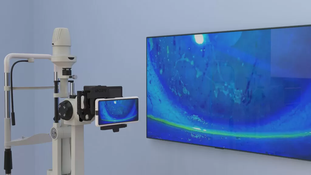 ocufy wide slitlamp tv