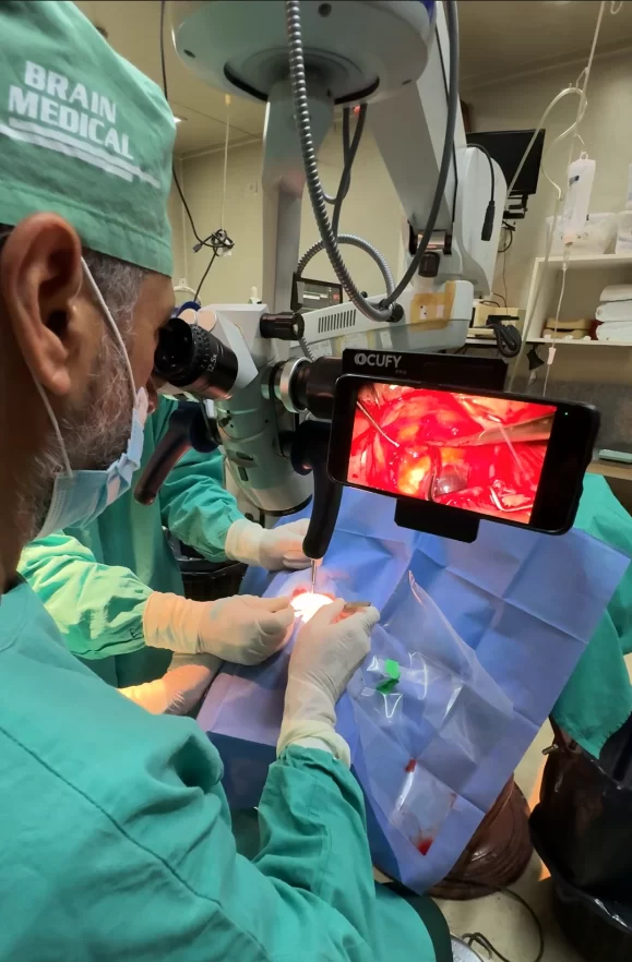 ocufy pro in use surgery microscope